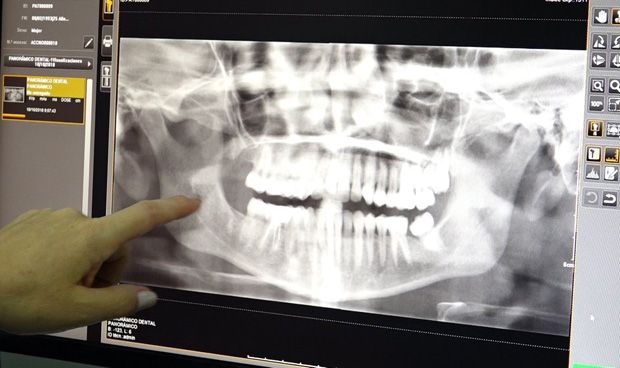 Compartir radiografías en redes sin el permiso del paciente es ilegal 