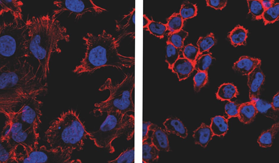 Los Pulsos Electromagnéticos Multifrecuencia No Ionizantes (MEMP) son capaces de discriminar entre células cancerosas y sanas a la hora de eliminar un tumor