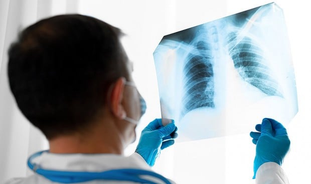 El cáncer supera a la patología respiratoria como principal causa de muerte
