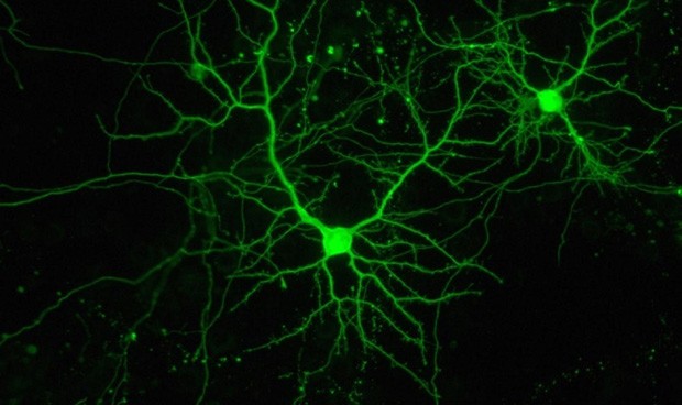 España participa en un proyecto para tratar tumores cerebrales con luz