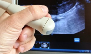 La ecografía logra diagnosticar el 73% de los cánceres de ovario malignos