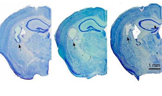 La seda, un biomaterial inocuo que puede reparar el cerebro