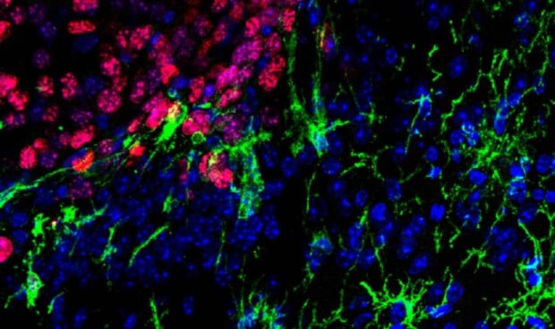 Un equipo del CSIC descubre una estrategia contra el melanoma