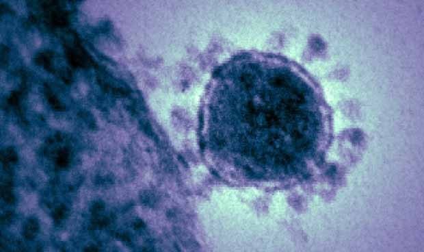 Una coalición financia proyectos para lograr vacunas contra el coronavirus