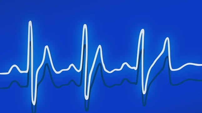 ¿Cómo se diagnostica el taponamiento cardiaco?